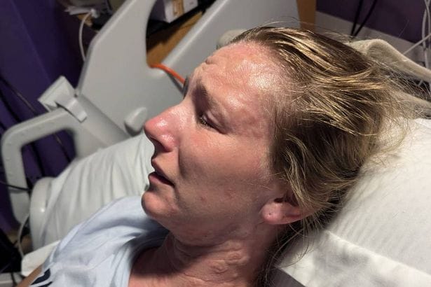 **Mother Paralyzed After Accident While Taking Down Laundry**